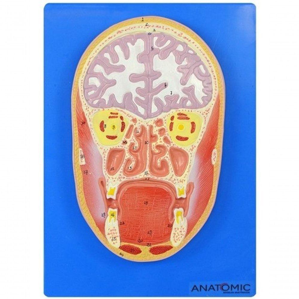 Cabeça Humana em Corte Frontal e Cérebro - 1