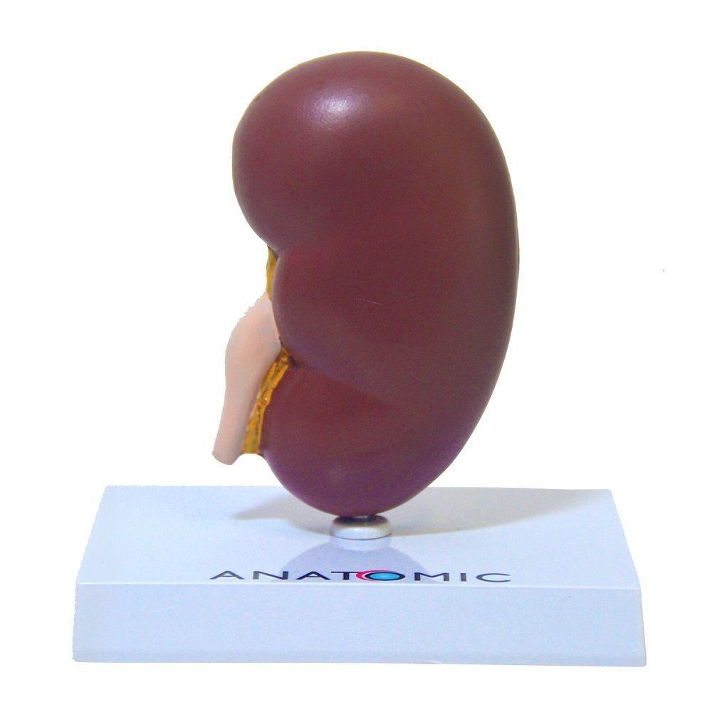 Rim Humano Com Patologias Corte Mediano, Anatomia - 4