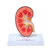 Rim Humano Com Patologias Corte Mediano, Anatomia - 2