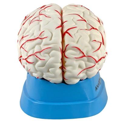 Cérebro com Artérias em 8 Partes