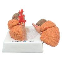 Cérebro Humano com Artérias em 9 Partes