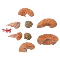 Cérebro Humano com Artérias em 9 Partes - 5