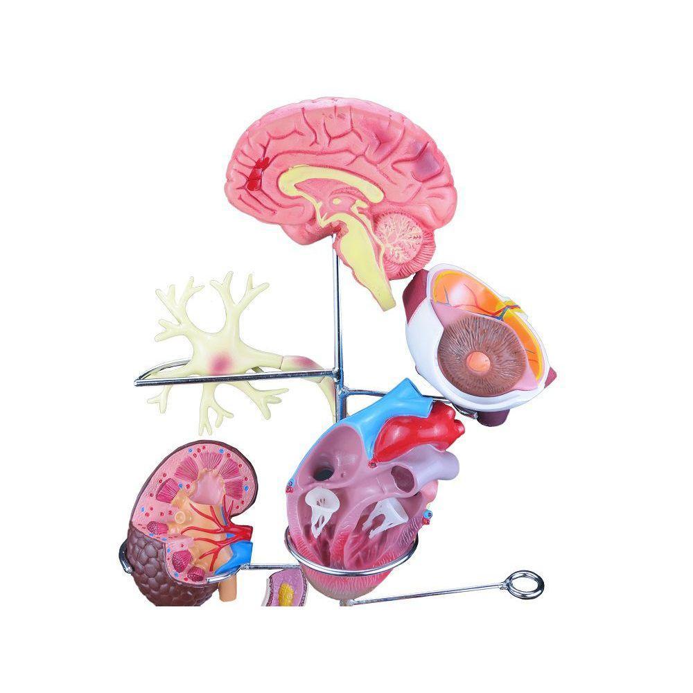 Modelo de Órgãos Afetados pela Diabetes em 11 Partes SD-5213 - 3