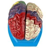 Cérebro Com Regiões Neuro-Funcionais, Em 8 Partes