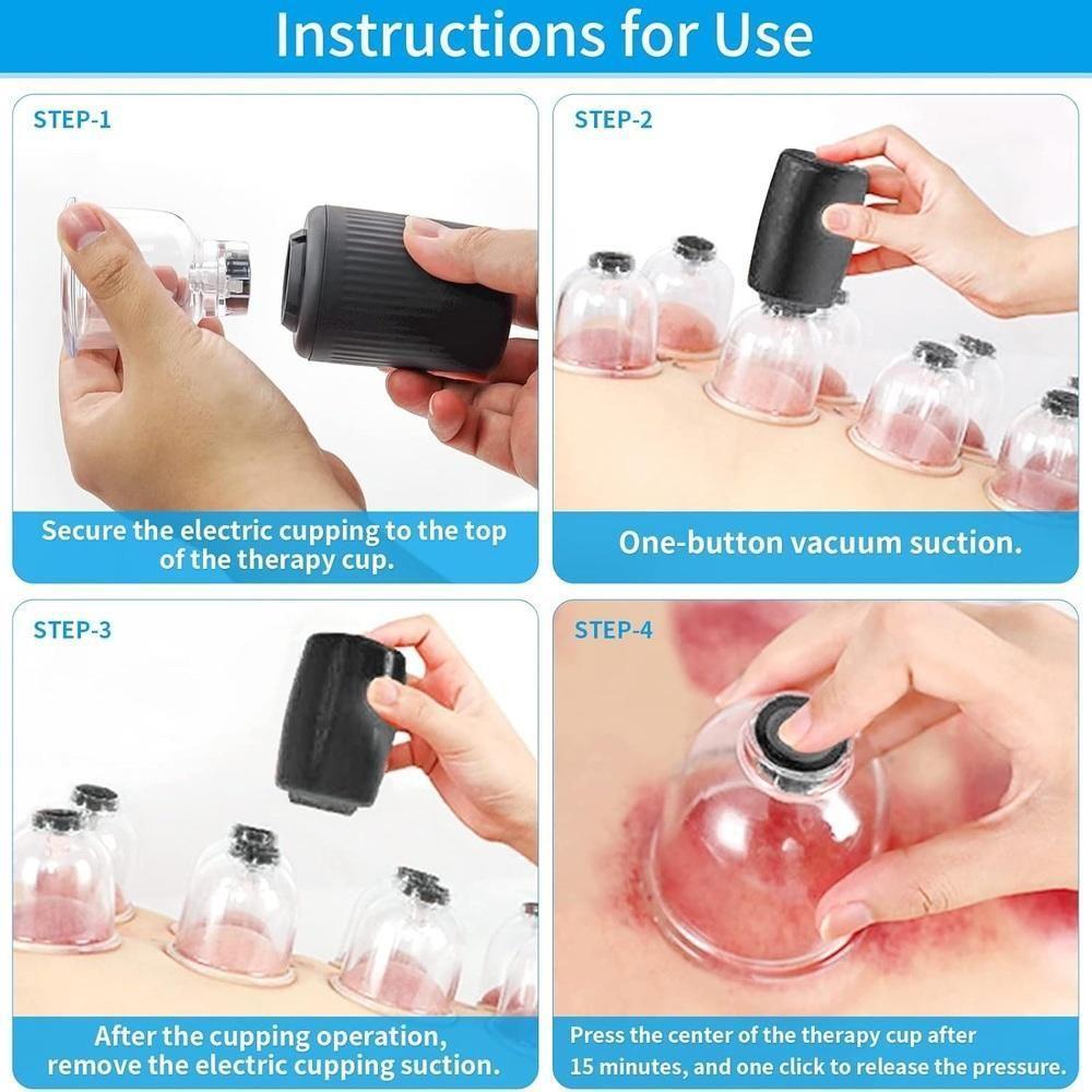 Ventosaterapia Eletrica Kit 6 Ventosas Copos Massageador Massoterapia Automatico Recarregavel Chines Acumputura Terapia - 6