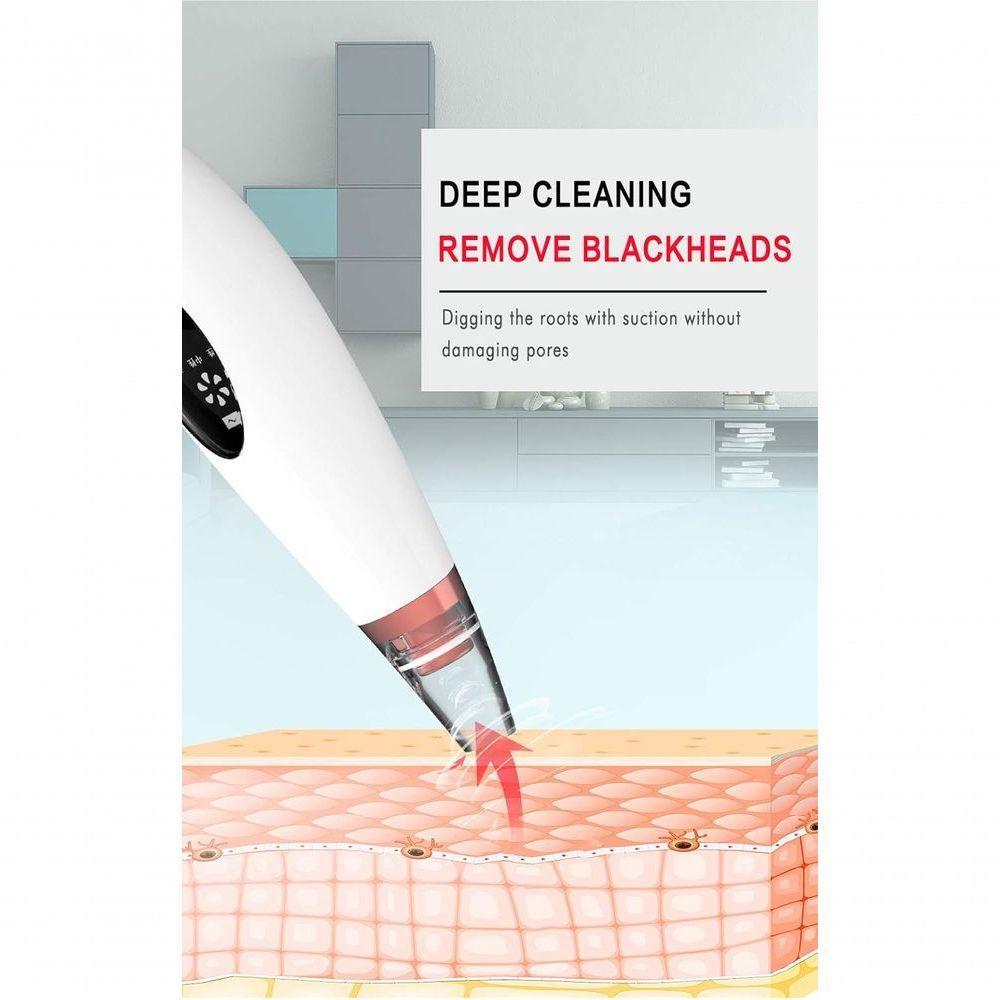 Extrator De Cravos Aparelho Removedor A Vácuo Recarregável 6 Cabeças Usb - 2