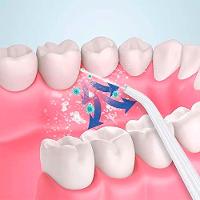 Irrigador Oral Jato D'água Higiene Bucal Sem Fio Verde - 3