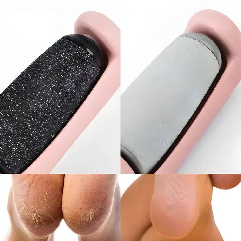 Raspador De Pé Eletrônico Calcanhar Remoção De Calos - 10