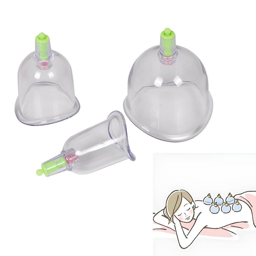 Kit Ventosas Com Bomba Ventosaterapia 6 Copos Massoterapia Chines Acumputura Terapia Succao Estetica - 2