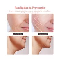 Aparelho De Massagem Facial Led Lift 3 Cores – Fototerapia, Vibração Sônica E Efeito Lifting Profissional Preto - 5