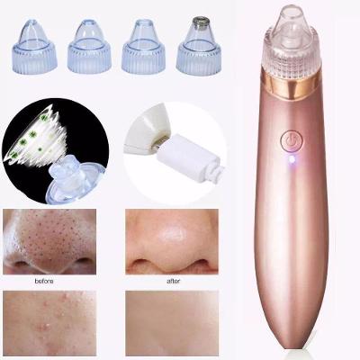 Removedor De Cravos E Espinhas Limpeza Facial Cor Rosa