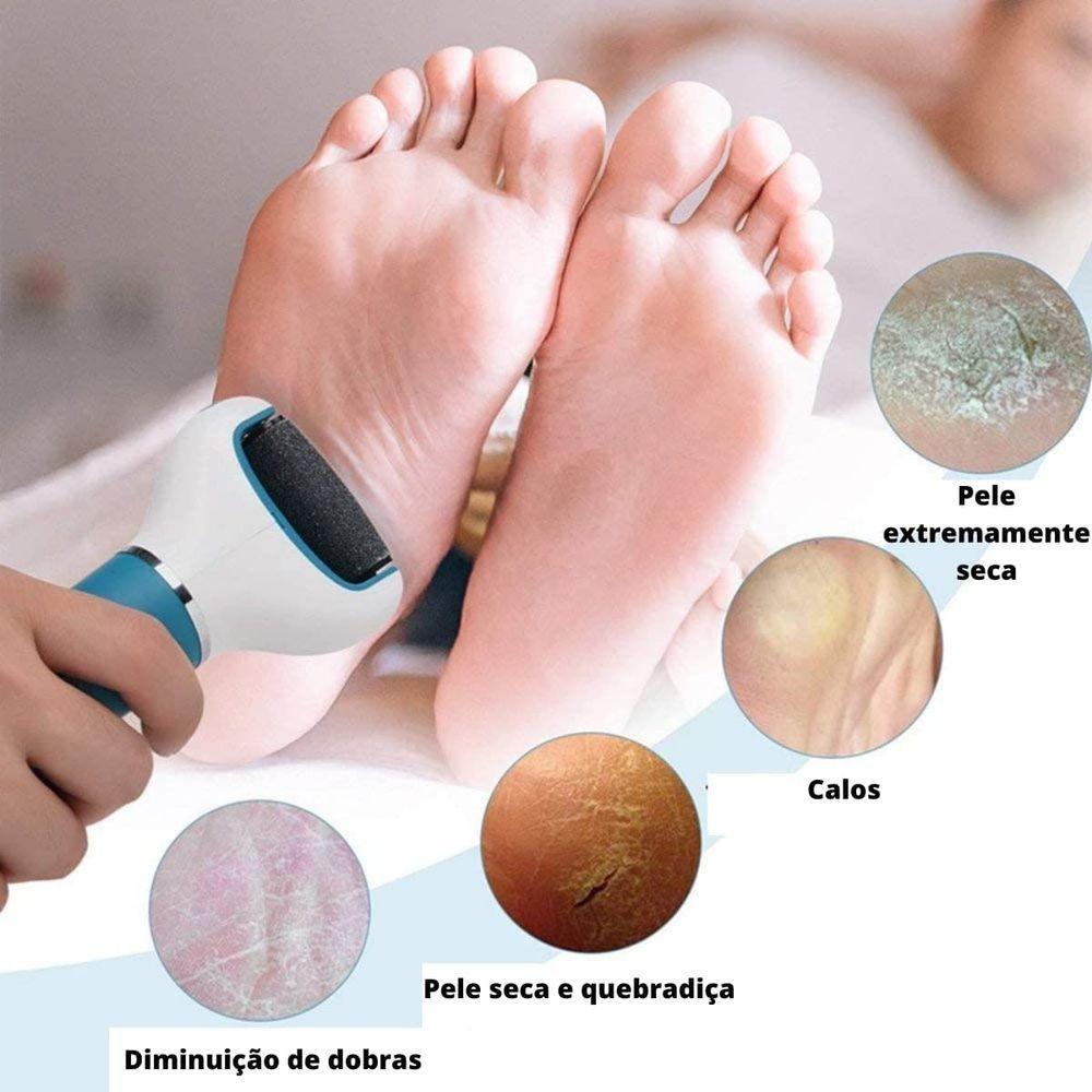 Esfoliador E Removedor De Calos Eletronico Lixa De Pé Portatil Recarregável Usb + 1 Refil - 2