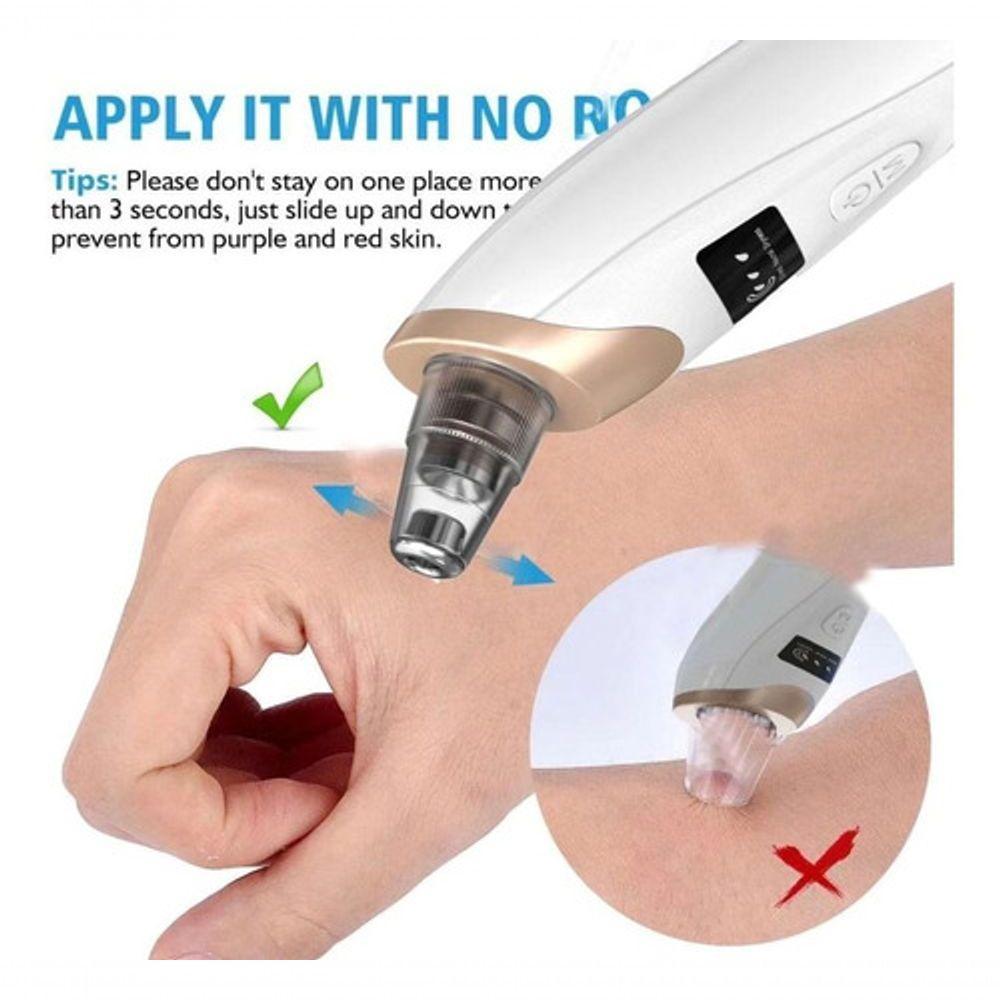 Aparelho Removedor De Cravos E Espinhas Elétrico - 8