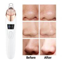 Aparelho Removedor De Cravos E Espinhas Elétrico - 3