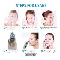 Aparelho Removedor De Cravos E Espinhas Elétrico - 7