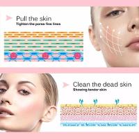 Máquina Sucção A Vácuo Remover Cravo Aparelho Removedo - 8